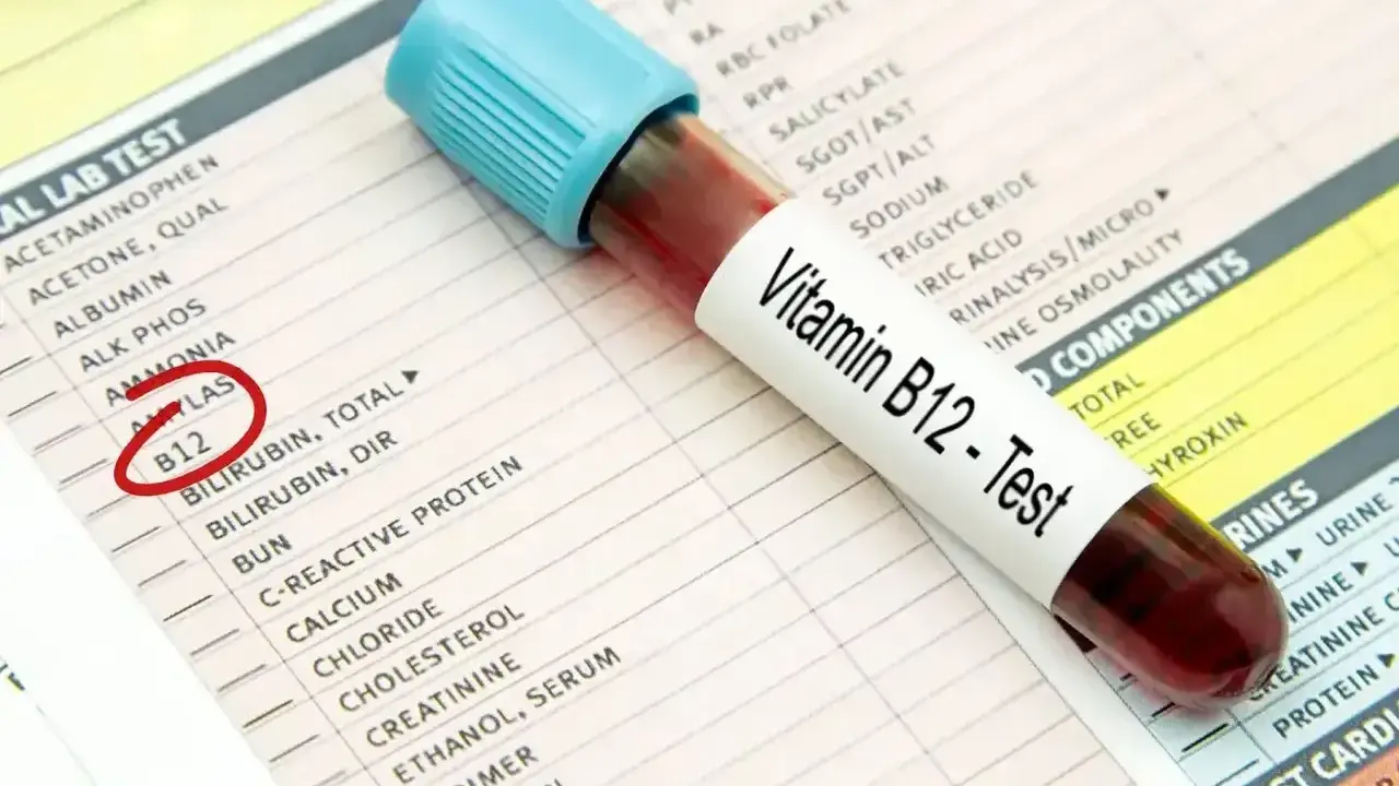Próbówka z krwią do testu witaminy B12 leży na karcie wyników badań. Czerwone kółko zaznacza pozycję "B12", sugerując diagnostykę niedoboru B12 ICD 10.