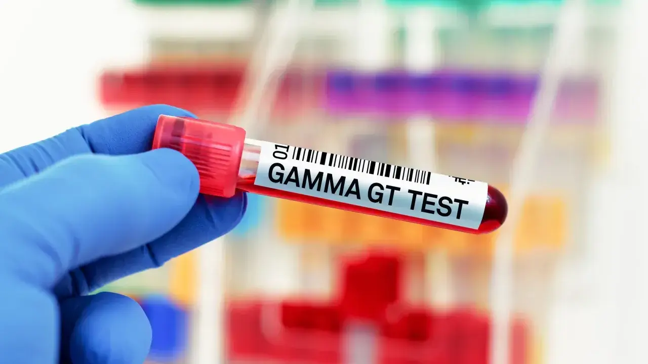 Ręka w niebieskiej rękawiczce trzyma probówkę z napisem "GAMMA GT TEST". Wynik badania wskazuje na ggtp norma.