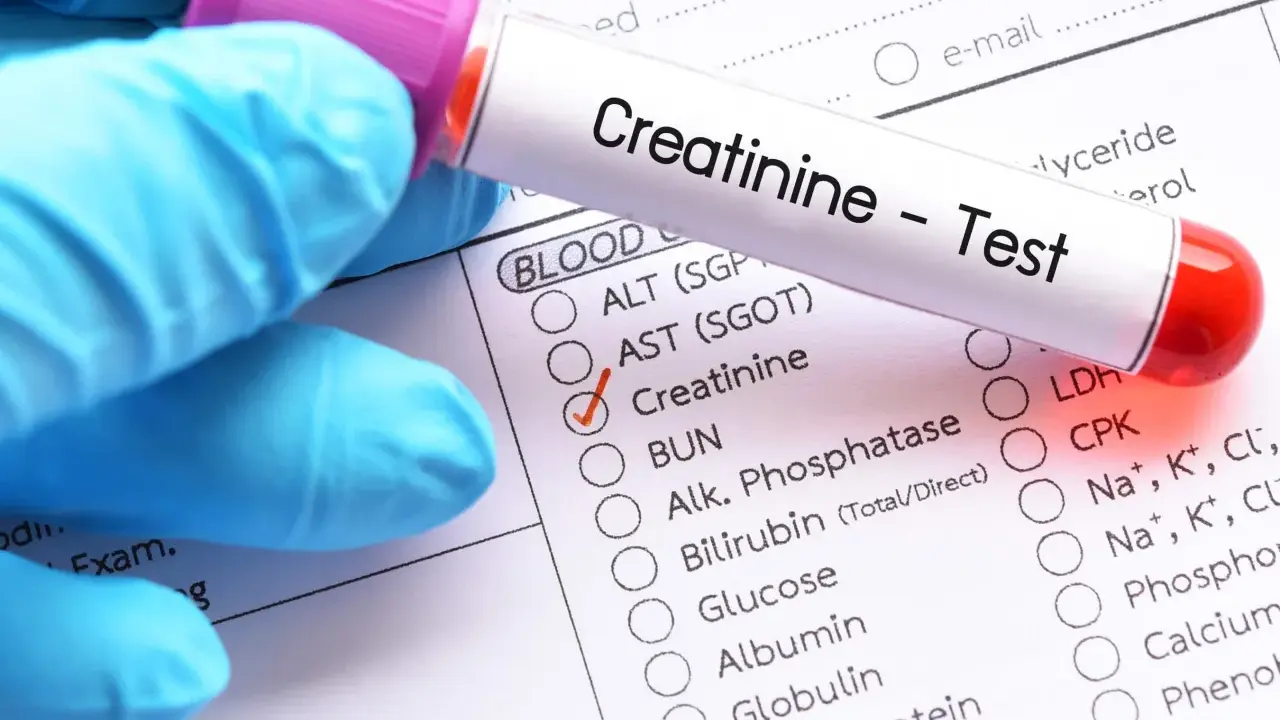 Rękawiczka w niebieskiej rękawiczce trzyma probówkę z napisem "Creatinine - Test". Zaznaczono pole "Creatinine" na formularzu z badaniami. To ważny krok, jak przygotować się do badania kreatyniny.