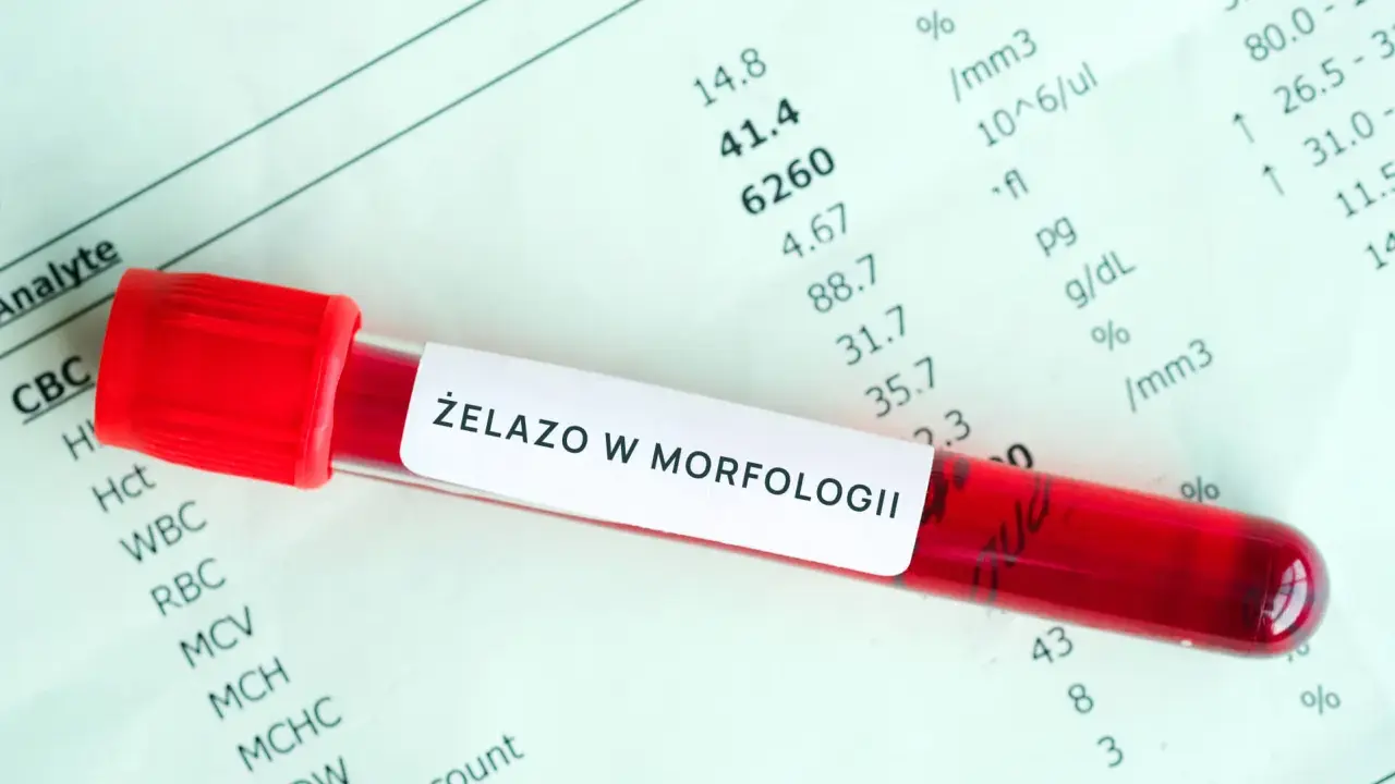 Probówka z krwią na tle wyników morfologii. Etykieta "ŻELAZO W MORFOLOGII" sugeruje badanie pod kątem przyczyn niedoboru żelaza.
