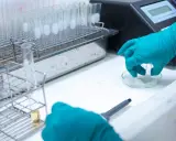 Badanie próbek kału w laboratorium, wykrywanie krwi utajonej w kale, kod ICD-10.