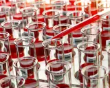 Próbówki z krwią do badań nad ostrą białaczką szpikową. Kropelka krwi spada z pipety, symbolizując postęp w diagnostyce i leczeniu.