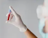 Ręka w białej rękawiczce trzyma probówkę z krwią. Wyniki wskazują na mchc niskie, co może wymagać dalszej diagnostyki.