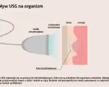 Badanie USG wykorzystuje fale ultradźwiękowe, które nie są szkodliwe dla organizmu.
