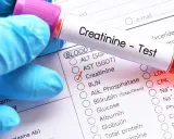 Rękawiczka w niebieskiej rękawiczce trzyma probówkę z napisem "Creatinine - Test". Zaznaczono pole "Creatinine" na formularzu z badaniami. To ważny krok, jak przygotować się do badania kreatyniny.