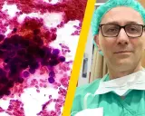 Mikroskopowy obraz komórek rakowych i lekarz w zielonym fartuchu i czepku.