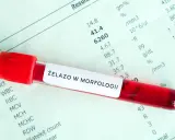 Probówka z krwią na tle wyników morfologii. Etykieta "ŻELAZO W MORFOLOGII" sugeruje badanie pod kątem przyczyn niedoboru żelaza.