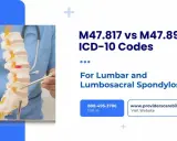 Model kręgosłupa z zaznaczonymi zmianami zwyrodnieniowymi. Mowa o kodach ICD-10 M47.817 i M47.896 dla spondylozy lędźwiowej.