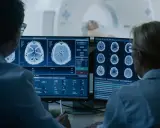Lekarze analizują obrazy mózgu z rezonansu magnetycznego, badając co oznacza obniżony sygnał w rezonansie magnetycznym.