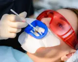 Zabieg fluoryzacji zębów w gabinecie stomatologicznym. Pacjentka w okularach ochronnych, dentysta aplikuje preparat.