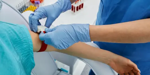 Pielęgniarka zakłada opaskę uciskową na rękę pacjenta, przygotowując się do pobrania krwi. To ważny krok, apo atorva na co.