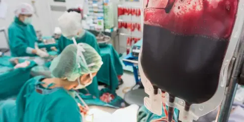 Worek z ciemną krwią czeka na podanie. W tle zespół medyczny w zielonych fartuchach, symbol nadziei, kiedy wiadomo, że przeszczep szpiku się przyjął.