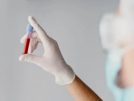 Ręka w białej rękawiczce trzyma probówkę z krwią. Wyniki wskazują na mchc niskie, co może wymagać dalszej diagnostyki.