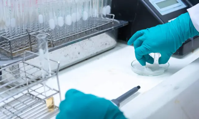 Badanie próbek kału w laboratorium, wykrywanie krwi utajonej w kale, kod ICD-10.