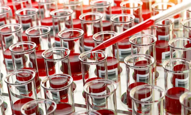 Próbówki z krwią do badań nad ostrą białaczką szpikową. Kropelka krwi spada z pipety, symbolizując postęp w diagnostyce i leczeniu.