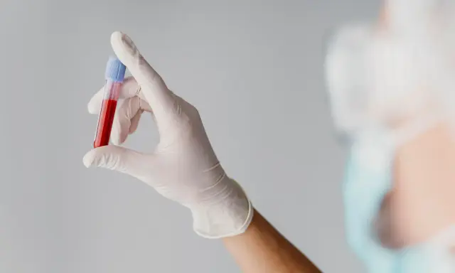 Ręka w białej rękawiczce trzyma probówkę z krwią. Wyniki wskazują na mchc niskie, co może wymagać dalszej diagnostyki.