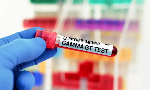 Ręka w niebieskiej rękawiczce trzyma probówkę z napisem "GAMMA GT TEST". Wynik badania wskazuje na ggtp norma.