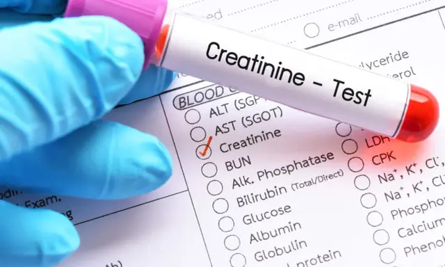 Rękawiczka w niebieskiej rękawiczce trzyma probówkę z napisem "Creatinine - Test". Zaznaczono pole "Creatinine" na formularzu z badaniami. To ważny krok, jak przygotować się do badania kreatyniny.
