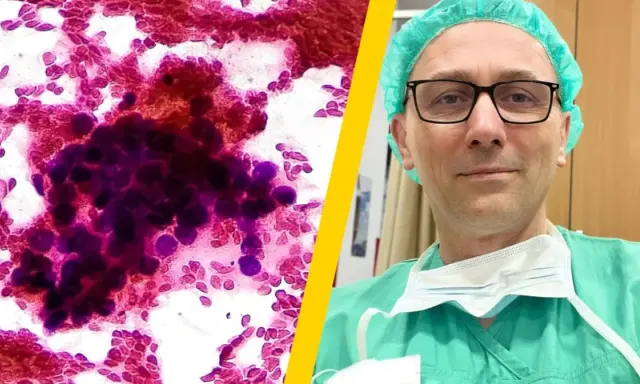 Mikroskopowy obraz komórek rakowych i lekarz w zielonym fartuchu i czepku.