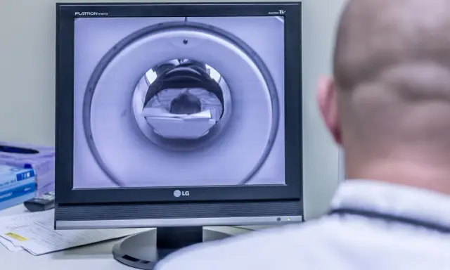 Opis rezonansu magnetycznego głowy. Na ekranie widać wnętrze aparatu MRI, przez które przechodzi pacjent.