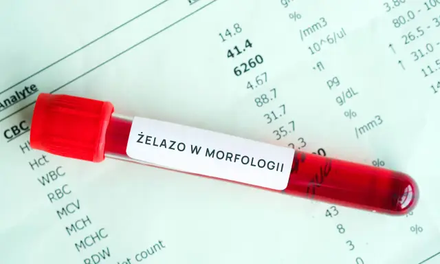 Probówka z krwią na tle wyników morfologii. Etykieta "ŻELAZO W MORFOLOGII" sugeruje badanie pod kątem przyczyn niedoboru żelaza.