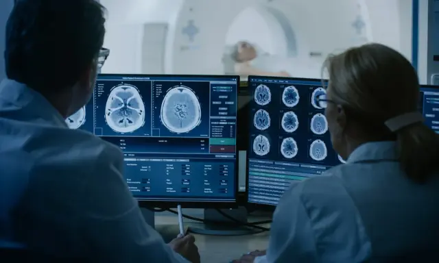 Lekarze analizują obrazy mózgu z rezonansu magnetycznego, badając co oznacza obniżony sygnał w rezonansie magnetycznym.