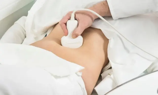 Lekarz wykonuje badanie usg prostaty. Pacjent leży pod białym obrusem, a sonda aparatu USG jest przykładana do brzucha.