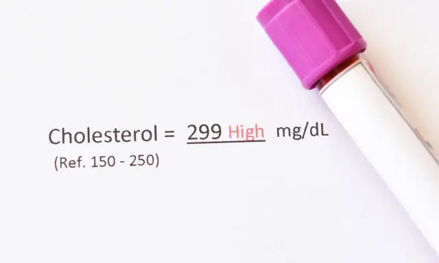 Wynik cholesterolu 299 mg/dL, co jest wysokim wynikiem. Czy ezoleta to statyna, która pomoże obniżyć ten poziom?