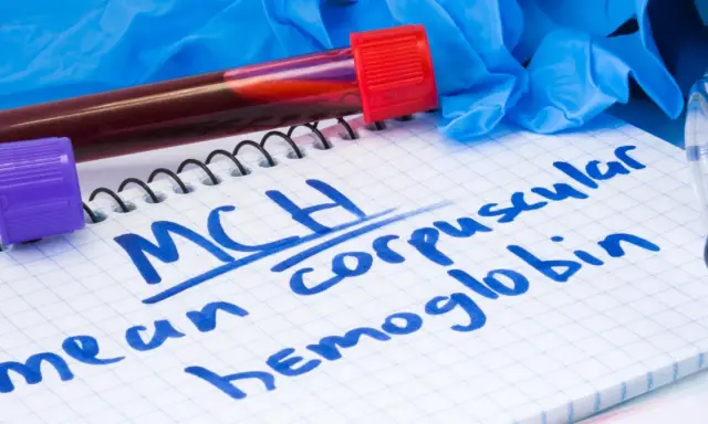 Notatnik z zapisanym "MCH mean corpuscular hemoglobin", probówki z krwią, rękawiczki i stetoskop. MCH podwyższone może wskazywać na pewne schorzenia.