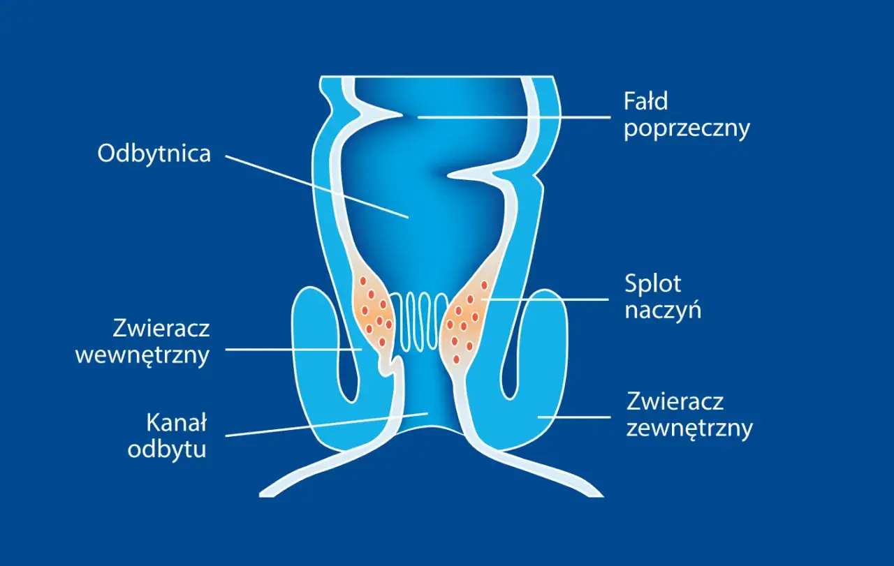 Schemat budowy odbytnicy z zaznaczonym splotem naczyń, kt&oacute;ry może być przyczyną ICD-10 hemoroidy.