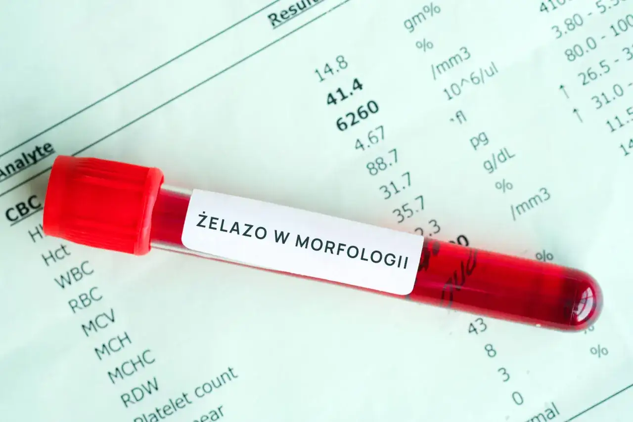 Pr&oacute;b&oacute;wka z krwią i wyniki morfologii. Etykieta 