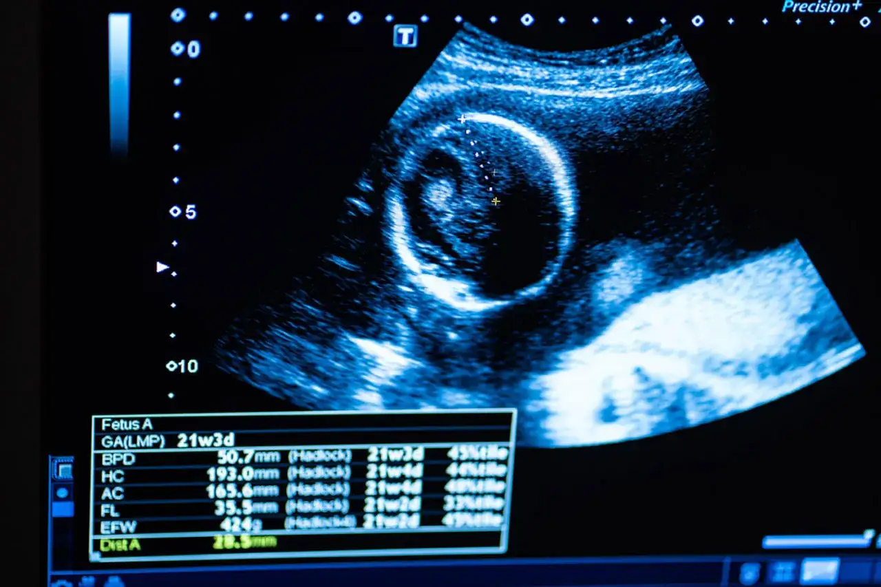 Obraz z badania USG płodu. Widoczny jest zarys główki dziecka, z zaznaczonymi wymiarami. Pod spodem tabelka z danymi, m.in. wiekiem ciążowym 21w3d.