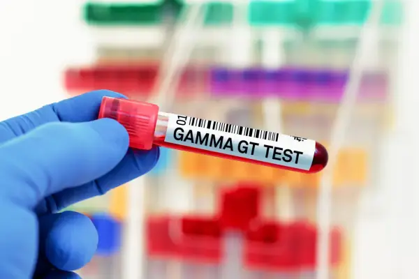 Ręka w niebieskiej rękawiczce trzyma probówkę z napisem "GAMMA GT TEST". Wynik badania wskazuje na ggtp norma.