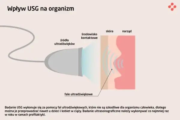 Badanie USG wykorzystuje fale ultradźwiękowe, które nie są szkodliwe dla organizmu.